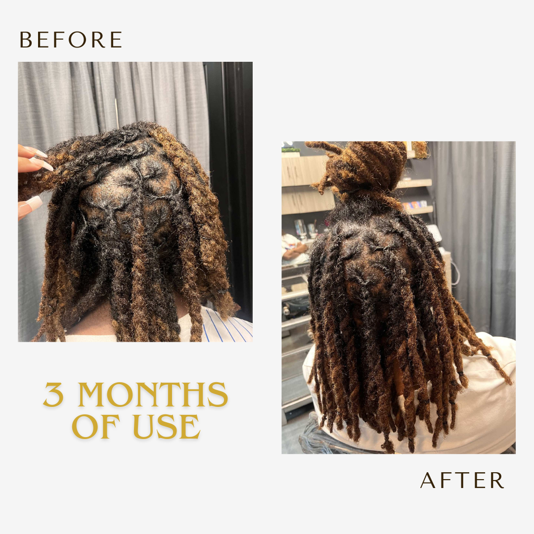 3 in 1 Loc Solution
