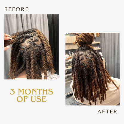 3 in 1 Loc Solution